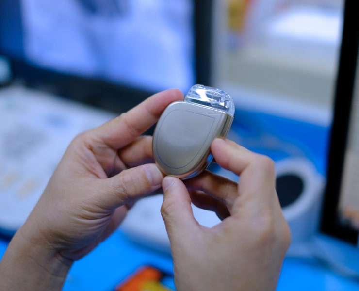 Blog article on implantable cardiac devices