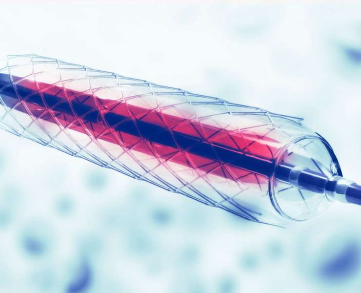 Interventional Cardiology procedures blog article