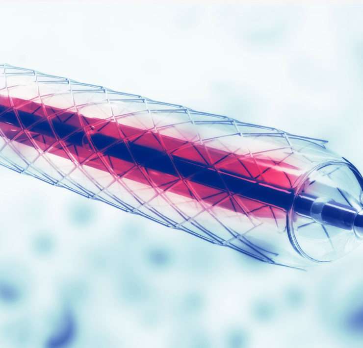 Interventional Cardiology procedures blog article